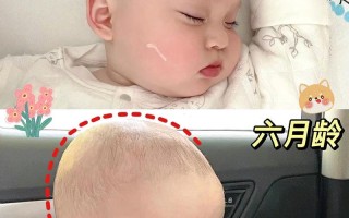 新生儿头顶高是正常发育还是异常信号？需警惕哪些潜在健康问题？