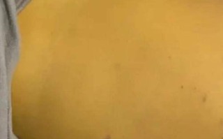 新生儿胆管闭塞存活率究竟有多高？手术治疗后长期生存质量如何保障？