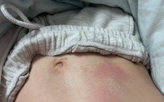 孕期晚上睡觉身上发烫是正常现象吗？需要担心哪些健康问题？