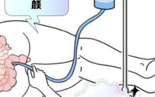 儿童灌肠究竟利大于弊还是弊大于利？家长该如何权衡风险与收益？