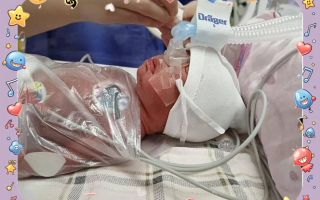 SLE50000新生儿呼吸机有何核心技术优势？