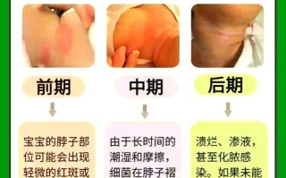 新生儿脖子淹了到底该摸什么？正确护理步骤和禁忌有哪些？