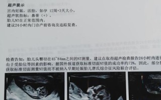 孕期12周NT检查是什么？有必要做吗？对胎儿有影响吗？