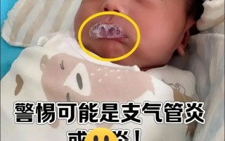 新生儿嘴吐沫是正常现象还是疾病信号？需警惕哪些潜在原因？