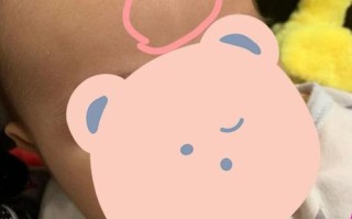 新生儿头顶软那块为什么不跳？是发育异常还是正常现象？