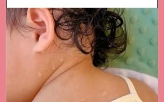 孩子一动就出汗，是体虚还是疾病？