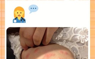 孕期长痒疙瘩怎么办？