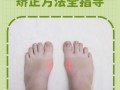 新生儿脚外翻矫正方法有哪些？不同矫正方式适用哪些情况？