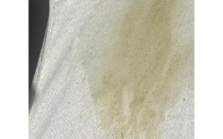 怀孕期间白带发黄发绿是感染了吗？对胎儿有影响吗？