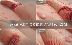 湿热皮肤病图片，湿热皮肤病图片大全