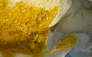 新生儿大便干燥肚子硬，是上火还是消化出了问题？