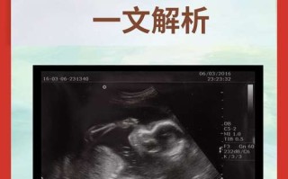 孕期cvt检查是什么