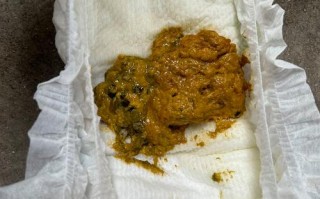 新生儿总是晚上拉大便