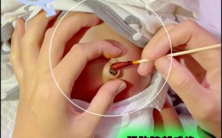 新生儿肠道感染有哪些典型症状？家长该如何识别与应对？