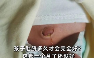 新生儿肚脐红肿流脓是感染了吗？该怎么护理才正确？