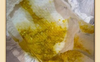 新生儿大便有水和奶瓣是消化不良还是生理性腹泻？