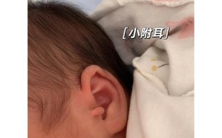 新生儿耳朵旁长福耳是福兆还是异常？需要关注哪些健康问题？