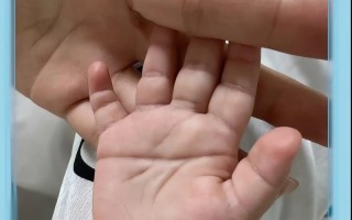新生儿断掌是异常征兆吗？是否会影响健康与发育？