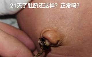 新生儿肚脐有臭味是感染了吗？该怎么护理才能避免问题？