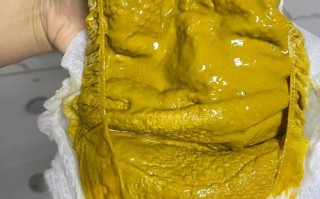 新生儿喝奶粉后出现水便分离，是奶粉不适应还是消化问题？