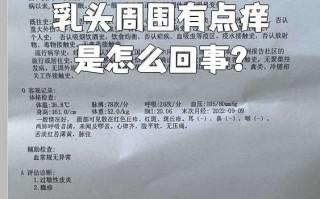 怀孕期乳头痒是正常反应还是疾病信号？该怎么缓解才安全？