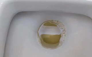 孕期尿蛋白升高有哪些明显症状？如何通过身体变化及早发现？