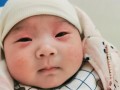 新生儿出生后眼皮肿多久能消肿？正常情况下需要几天？