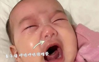 新生儿睡觉鼻子像有痰是正常现象吗？需要担心吗？