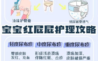 新生儿尿不湿过敏红肿哭闹，这3步护理能快速缓解吗？