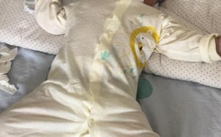 新生儿黄疸轻度脑损伤会影响宝宝发育吗？如何及时发现与干预？