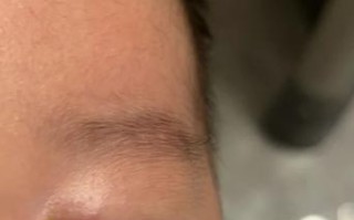 新生儿白眼球发黄是黄疸吗？需要就医检查吗？