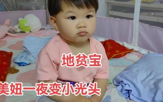 地贫儿童外貌特征有哪些具体表现？图片展示能帮助早期识别吗？