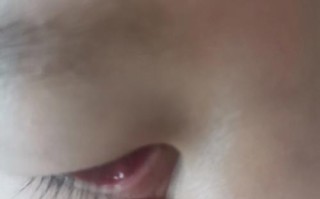 新生儿眼睛里有丝状物