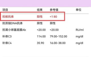 新生儿抗感染的主要抗体有哪些？它们是如何发挥保护作用的？