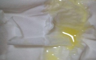 孕期出现黄绿色分泌物是感染了吗？对胎儿有影响吗？需要怎么处理？