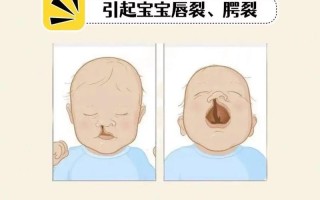 新生儿肾上腺皮质增生症有哪些典型表现？