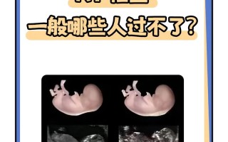 孕期彩超究竟能检查出哪些关键问题？胎儿健康与发育情况全解析！