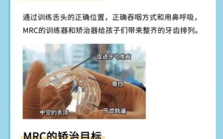 儿童MRC矫正怎么做？