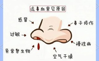 孕期流鼻血是身体发出的什么信号？需警惕哪些潜在健康风险？