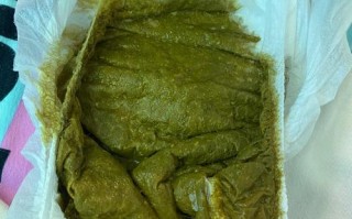 新生儿排出绿色颗粒状粪便，是消化不良还是感染信号？