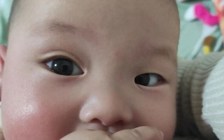 新生儿眼睛总上下左右瞟是正常现象还是发育异常？
