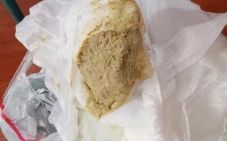 五岁儿童大便发白是消化问题还是肝胆异常？家长需警惕哪些信号？