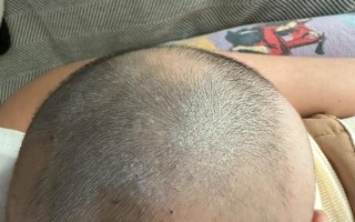 孕期吃什么真能让宝宝头发多又黑？