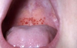 新生儿嗓子发红是上火还是生病？需要家长注意哪些信号？