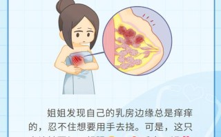 孕期乳房胀痛痒怎么办