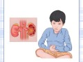 儿童肾病究竟是什么原因悄悄盯上孩子的肾脏健康？