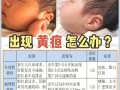 新生儿黄疸260μmol/L算严重吗？需要照蓝光治疗吗？