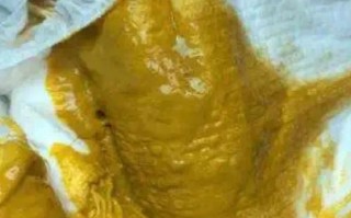 新生儿粑粑酸臭是正常现象吗？需要调整喂养方式吗？