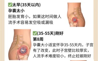 孕期怎样知道自己流产？有哪些典型症状需要警惕？