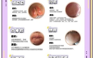 新生儿湿疹严重不治会怎样？